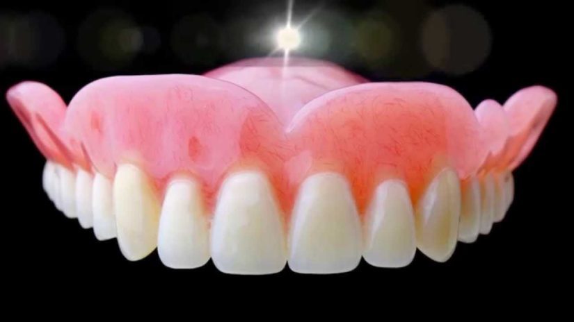 Cómo cuidar sus dentaduras postizas