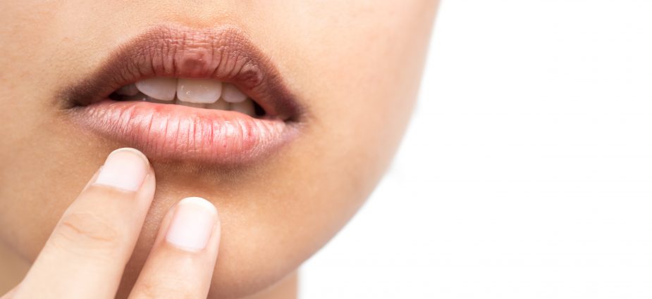 Understanding Dry Mouth